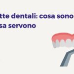 Illustrazione dell’applicazione di una faccetta dentale su un dente, con titolo “Faccette dentali: cosa sono e a cosa servono” – Studio TG Dental a Borgata Finocchio